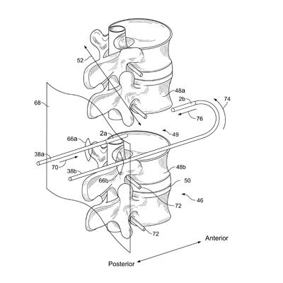 A-patent-drawing-illustration